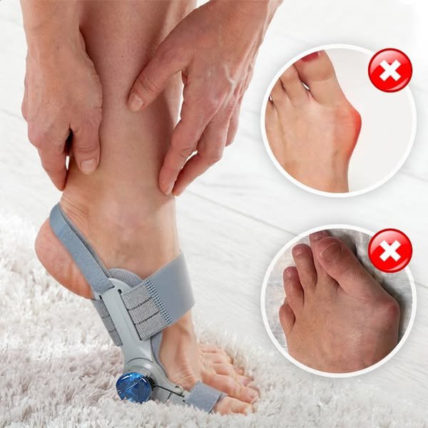 BuniCure adjustable bunion corrector on foot
