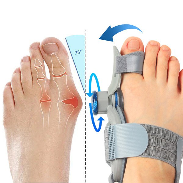 BuniCure orthopedic toe alignment support