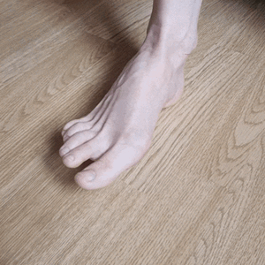 BuniCure worn at home
